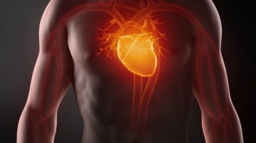 Estudio DELIVER: Reducción de mortalidad y empeoramiento en pacientes con falla cardiaca preservada