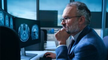 Herramienta de IA de Mayo Clinic identifica nueve tipos de demencia, incluido el Alzheimer, con solo una prueba de imagen