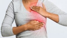 Cáncer de mama inflamatorio: Una forma de rápida evolución que a menudo no presenta un bulto como señal de alarma